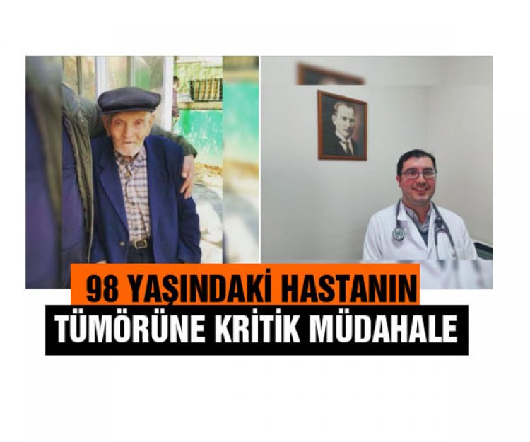 98 YAŞINDAKİ HASTANIN TÜMÖRÜNE KRİTİK MÜDAHALE